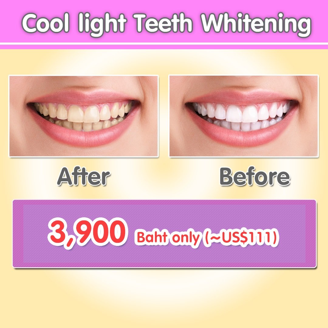 Pattaya Dental Clinic - Promotion - Coolight