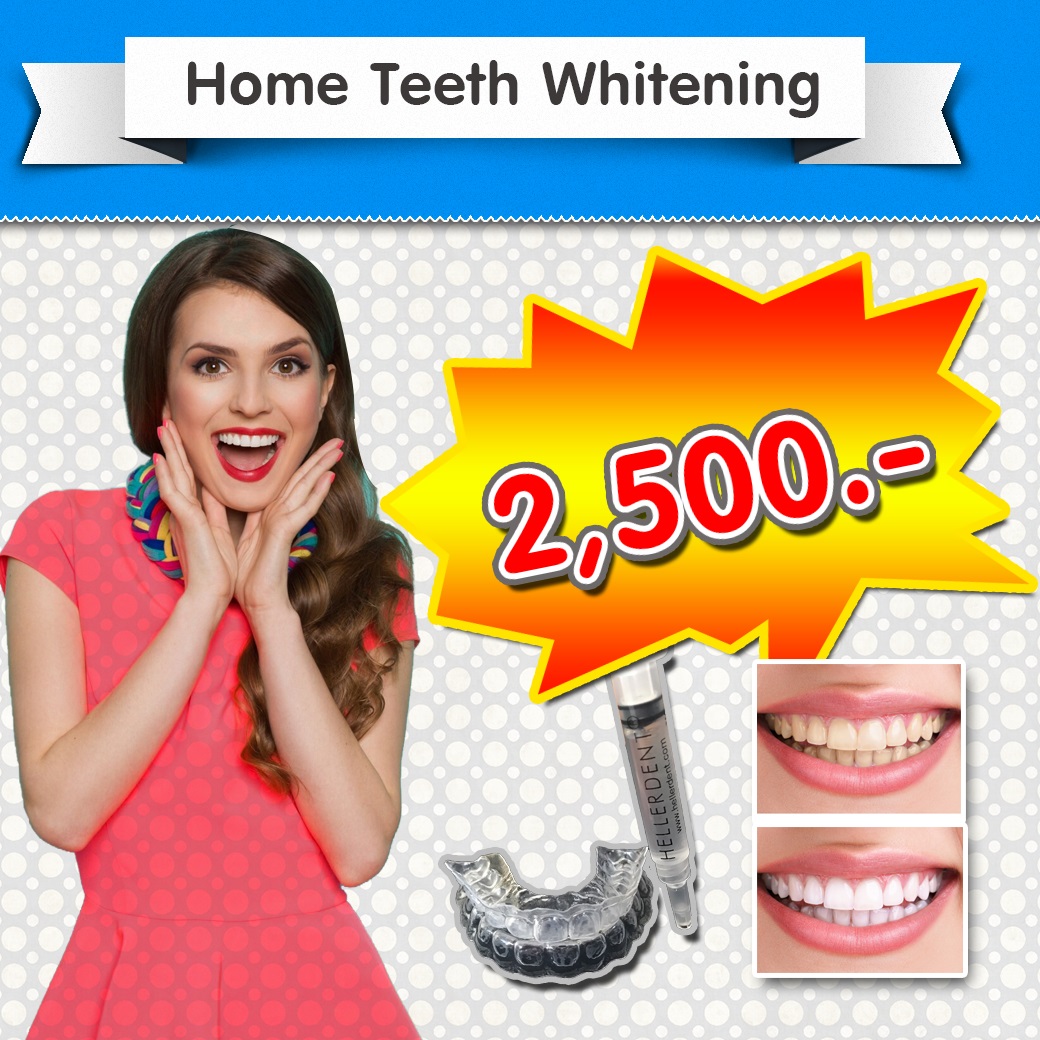 attaya Dental Clinic - Promotion - Home Teeth Whitening