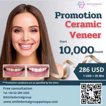 Promotion-Ceramic-Veneer Promotion-Ceramic-Veneer