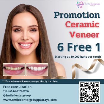 Promotion-Ceramic-Veneer-6-free-1 Promotion-Ceramic-Veneer-6-free-1
