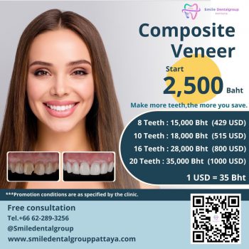 Promotion-Composite-Veneer Promotion-Composite-Veneer