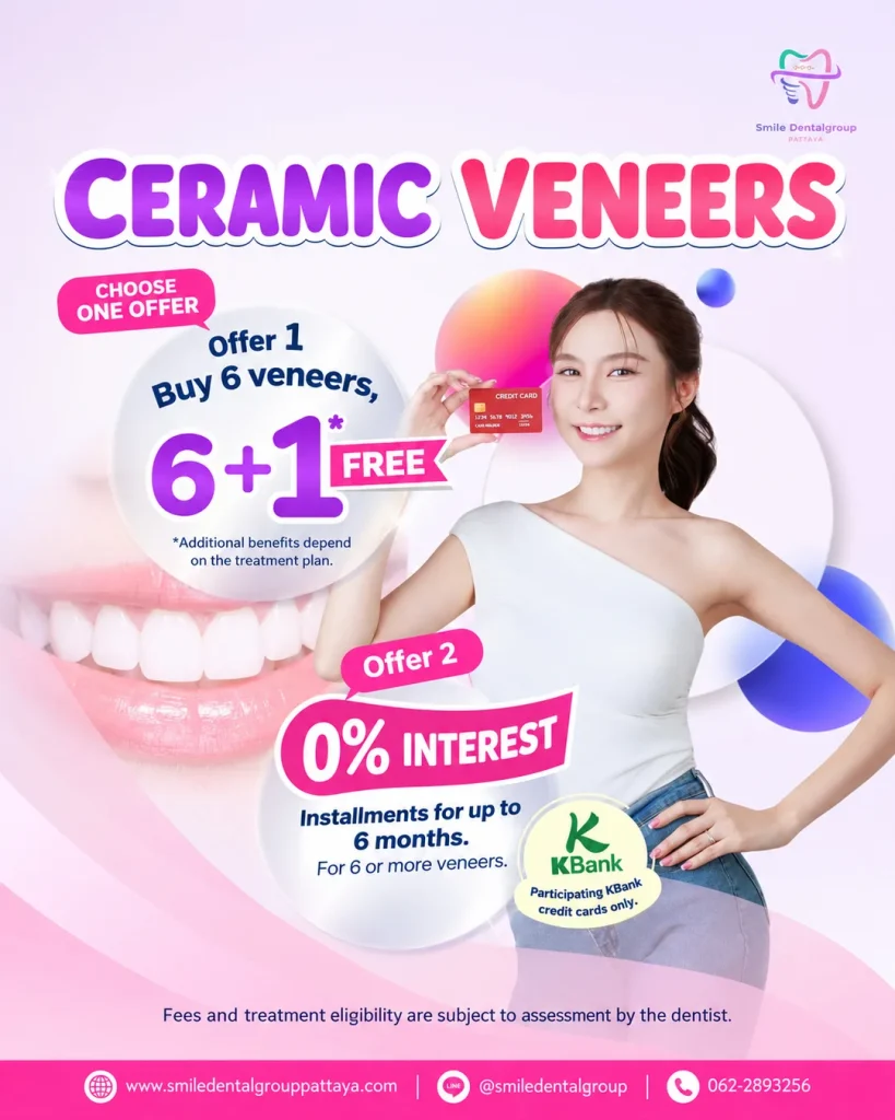 Ceramic veneers promotion: buy 6 get 1 free, or 0% interest installments for up to 6 months