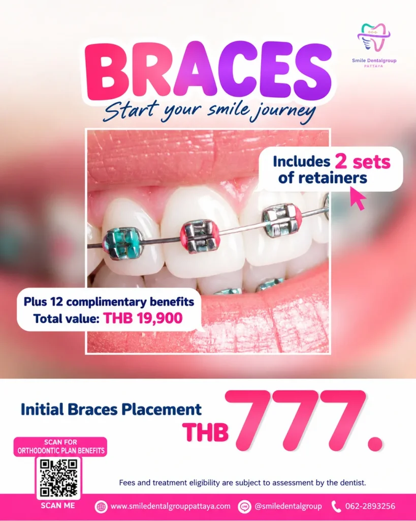 Braces promotion: initial braces placement THB 777, includes 2 sets of retainers and 12 complimentary benefits worth THB 19,900