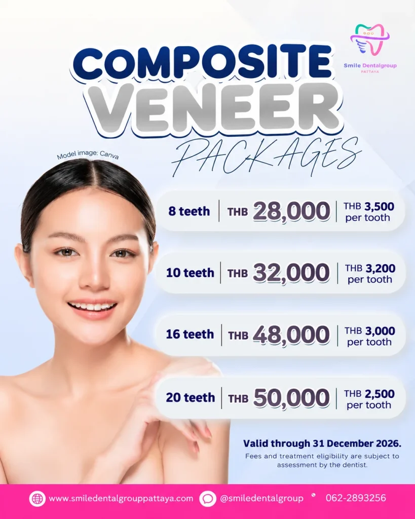 Composite veneer packages: 8 teeth THB 28,000, 10 teeth THB 32,000, 16 teeth THB 48,000, 20 teeth THB 50,000