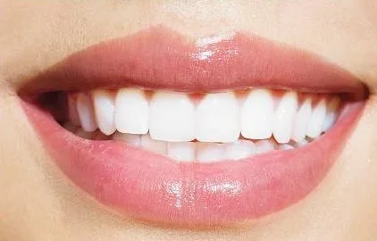 Teeth after whitening